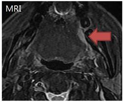 MRI 촬영사진