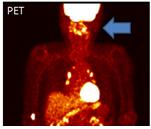PET 촬영사진
