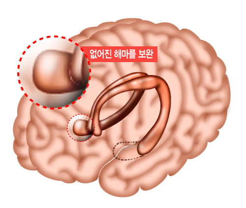 1. 해마