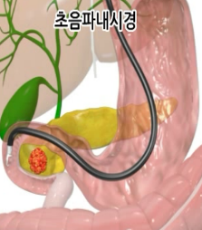 내시경