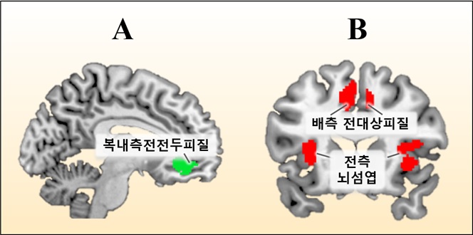 아래 설명 참조