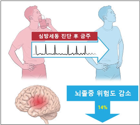 뇌졸중 위험도 감소 14%