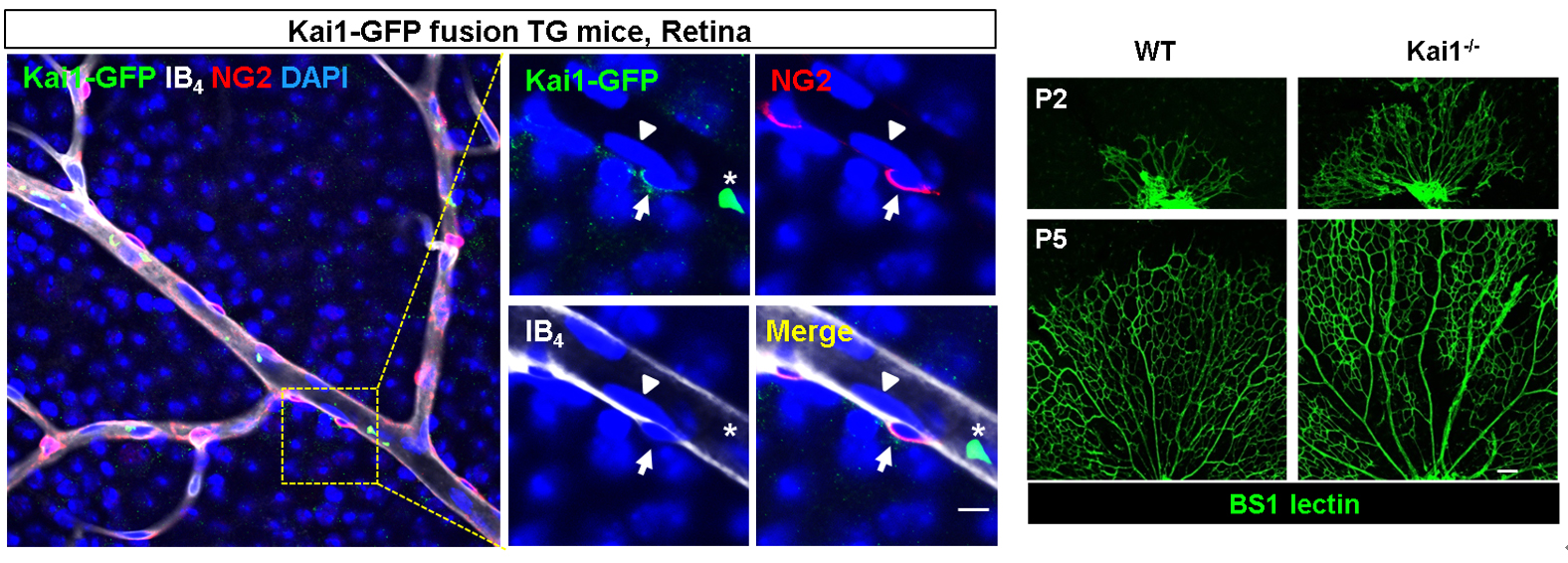 그림 3) 마우스 망막의 혈관 주변에 위치하고 있는 주피세포에서 발현되는 카이-원. 우측 사진에서 보듯이, 카이 유전자를 낙아웃시키면 망막혈관이 과잉증식함.