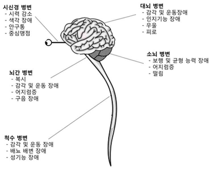 다발성 경화증 병변 위치에 따른 다양한 증상