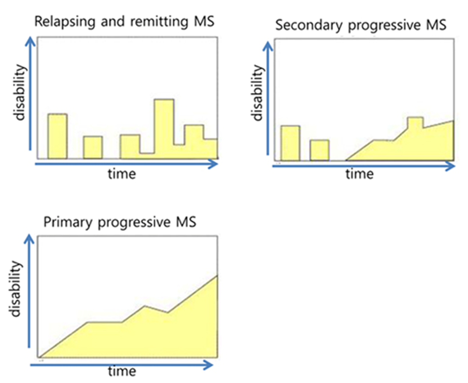 다양한 다발성 경화증의 임상 경과