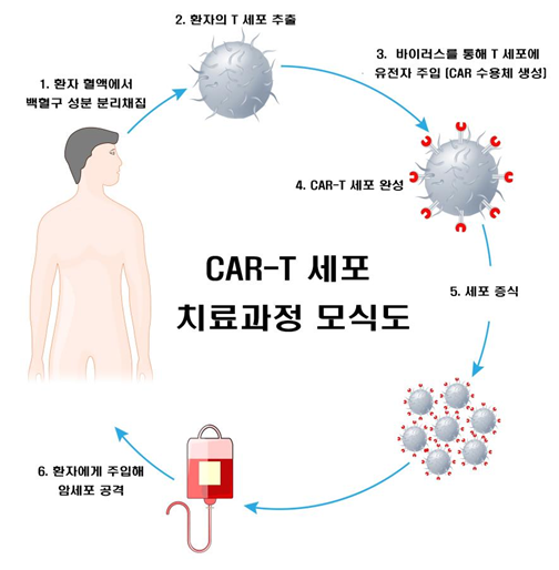 CAR-T 세포 치료과정 모식도