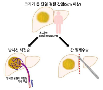 [사진1] 연구대상 구분 방법