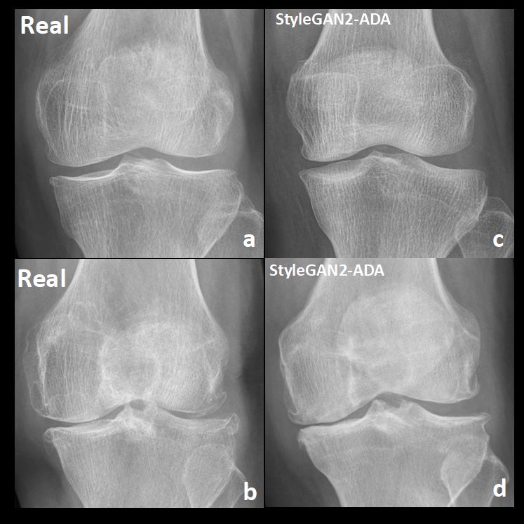 실제 무릎 이미지와 알고리즘 모델을 통해 생성된 이미지