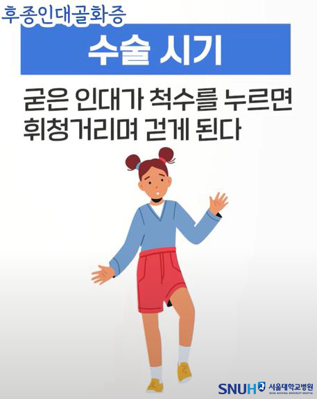 후종인대골화증 수술 시기