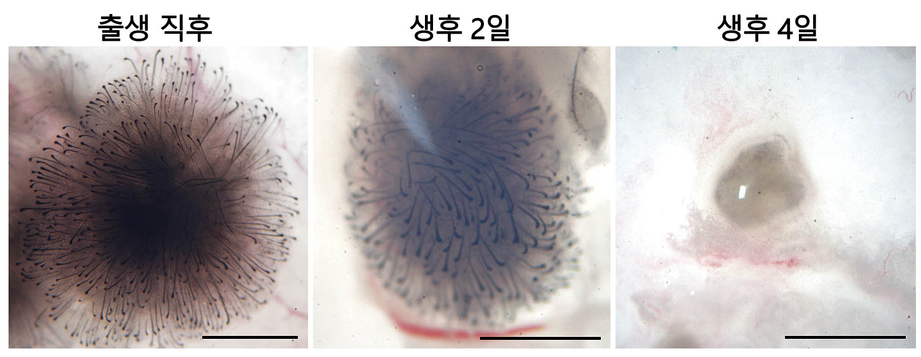 생후 0~4일째 섬유아세포 모습 비교. 