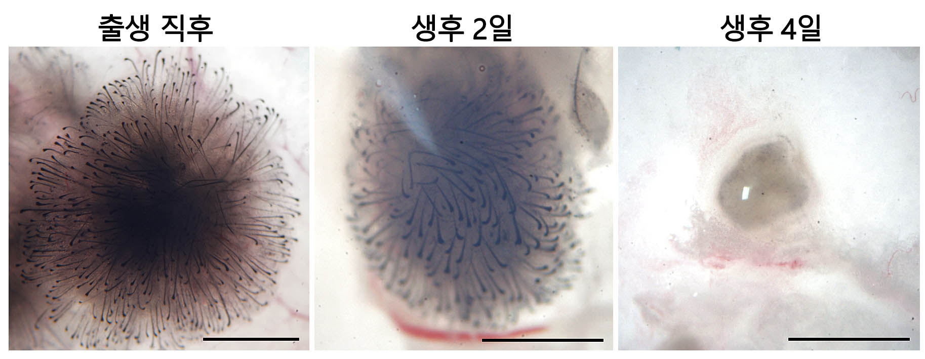 생후 0~4일째 섬유아세포 모습 비교. 생후 0~4일째 섬유아세포 모습 비교.