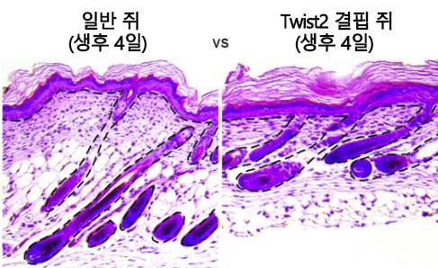 Twist2 전사인자가 결핍된 쥐와 일반 쥐의 피부 비교 Twist2 전사인자가 결핍된 쥐와 일반 쥐의 피부 비교