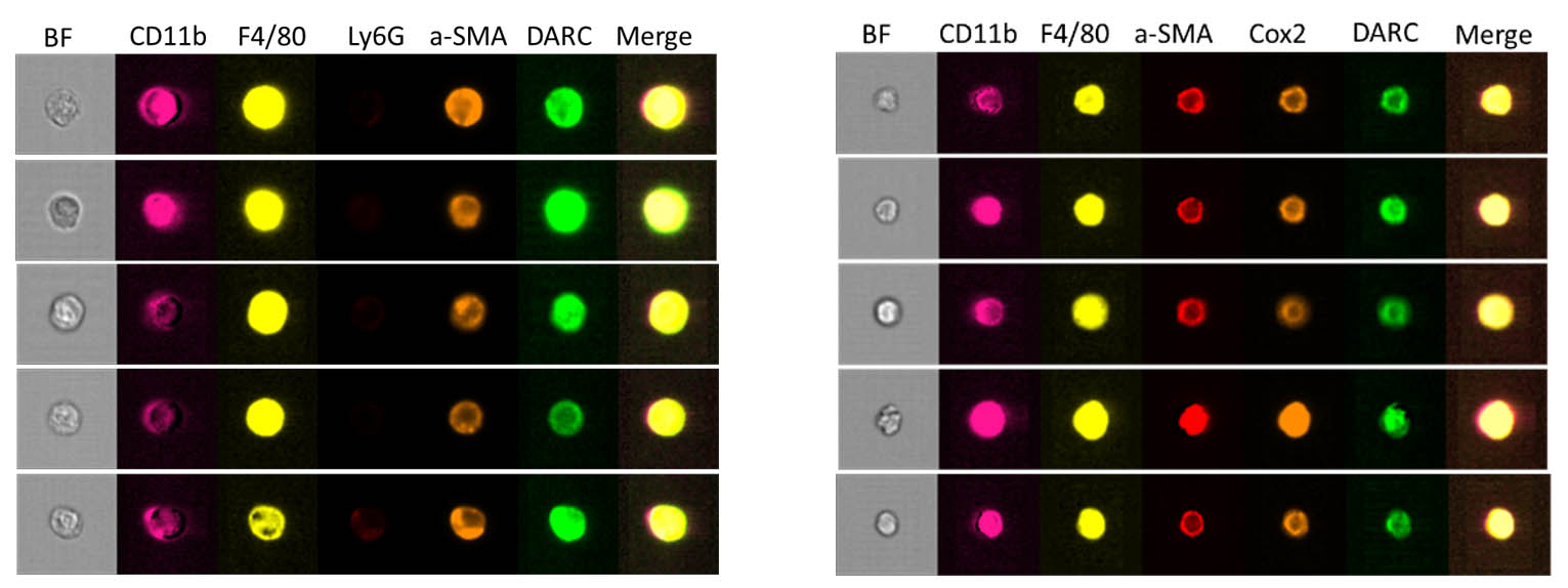 αSMA+COX2+DARC(ACKR1)+ 단핵구/대식세포를 단일세포 수준에서 확인함