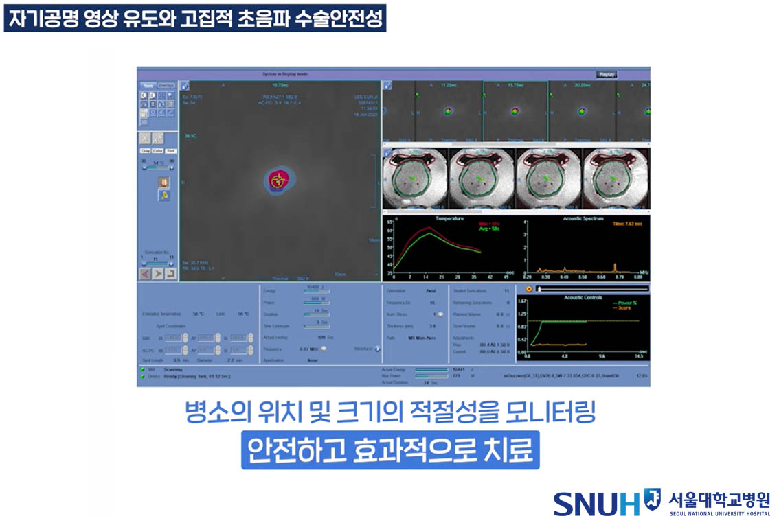 자기공명 영상 가이드 화면 자기공명 영상 가이드 화면