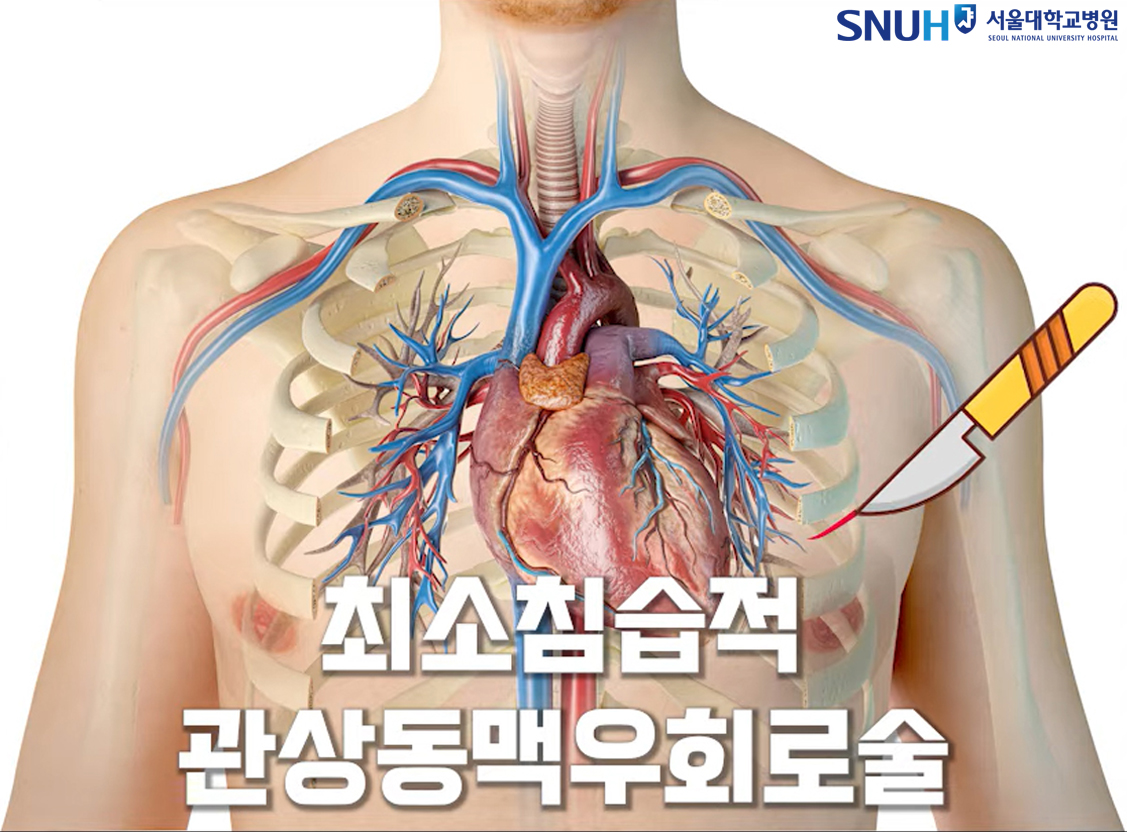 최소침습적 관상동맥우회로술