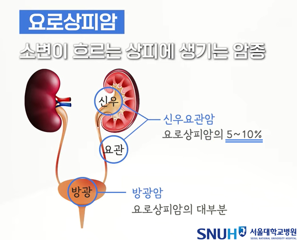 요로상피암 그림