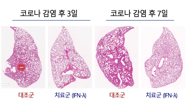 폐 조직분석 결과(염증 부위 분홍색)