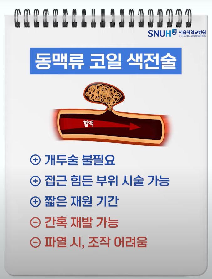 동맥류 코일 색전술 특징