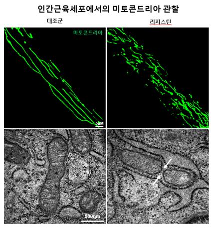 리지스틴을 처리한 근육세포의 미토콘드리아가 과도하게 분열·파괴되고 있는 현상