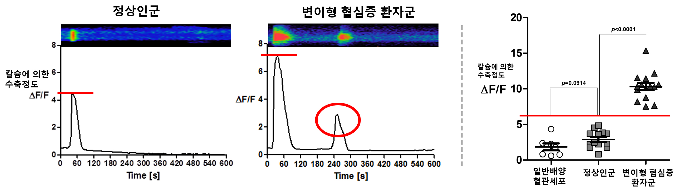 정상인군 및 변이형 협심증 환자군의 칼슘에 의한 수축정도 비교(좌) 및 정량화 결과(우)