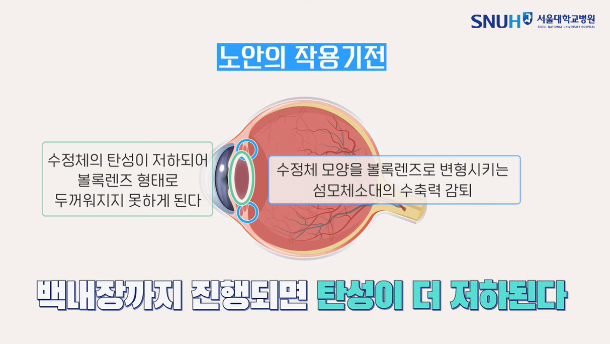 노안의 작용 기전