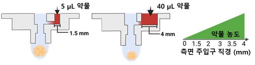 측면 주입구의 직경 변경을 통한 최종 약물 농도 조정