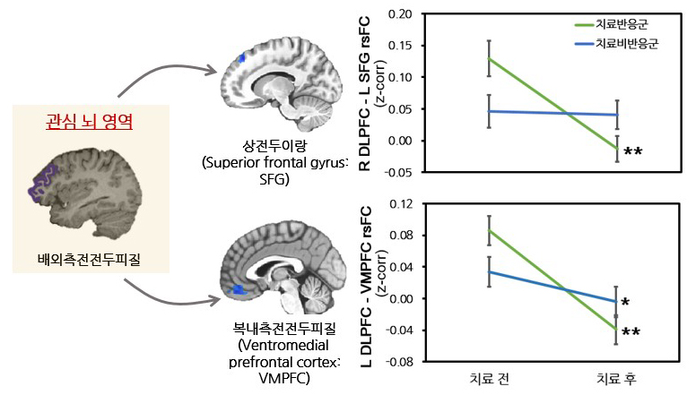 항우울제 치료 전후 배외측 전전두피질 휴지기 기능적 연결성의 변화