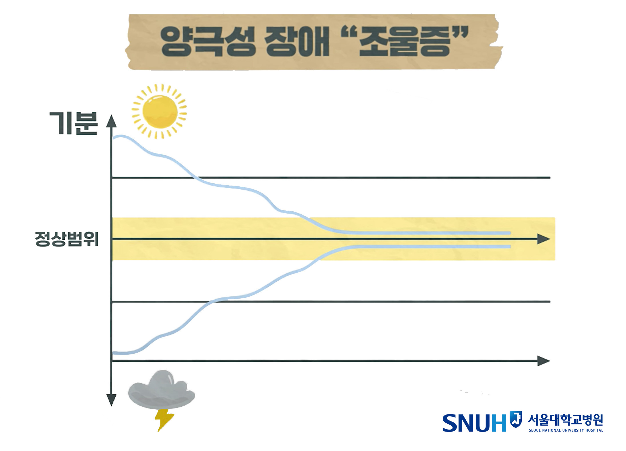 양극성 장애 조울증