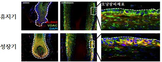 휴지기 모낭과 성장기 모낭에서 ALDH2 발현 비교
