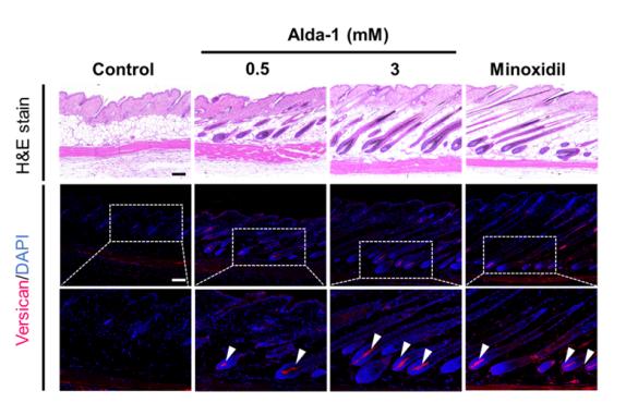 동물실험에서 ALDH2 활성화제(Alda-1)  처리 후 모발 성장기 유도 확인 