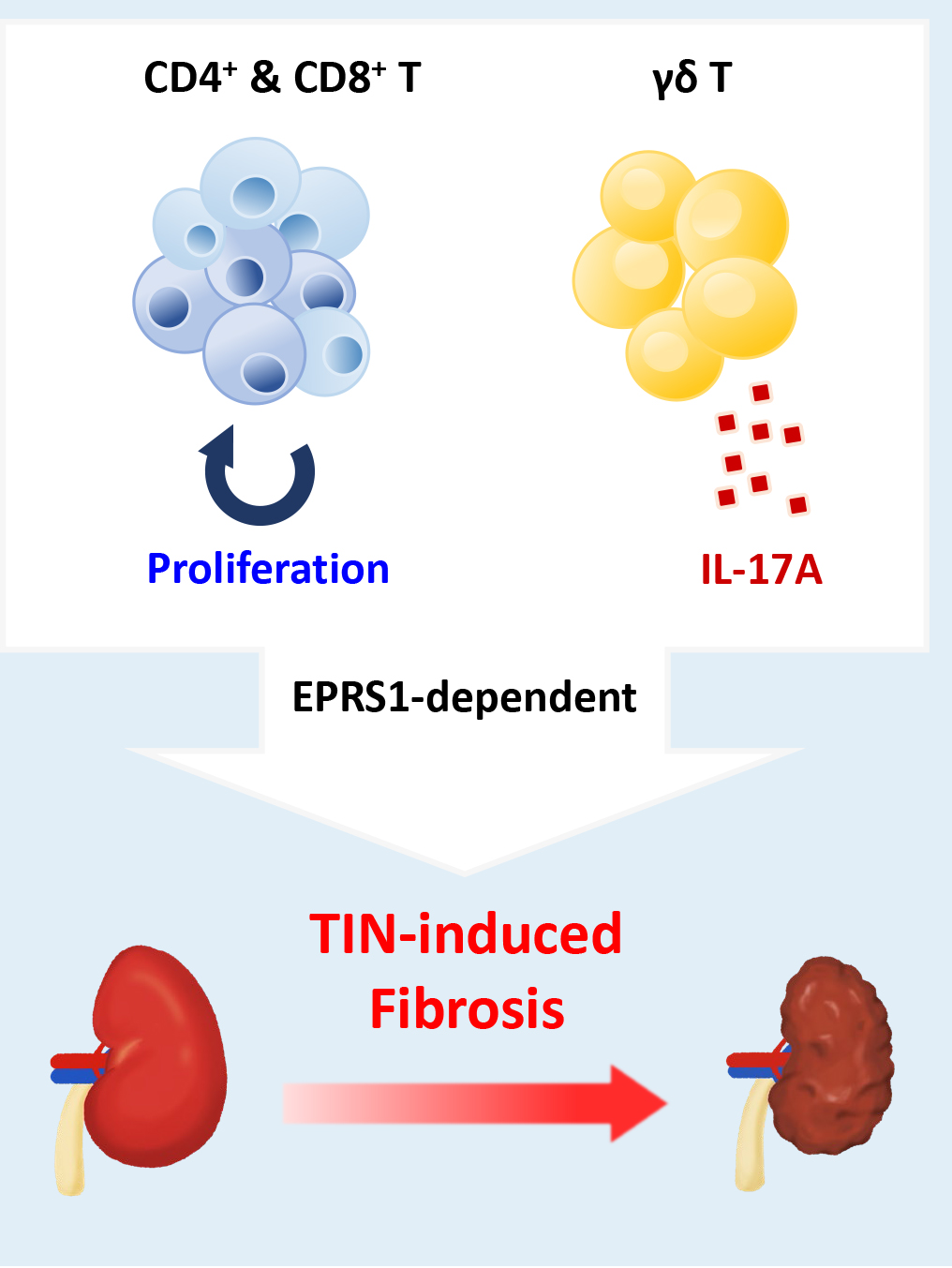 신장 염증 악화와 관련된 ‘EPRS1’