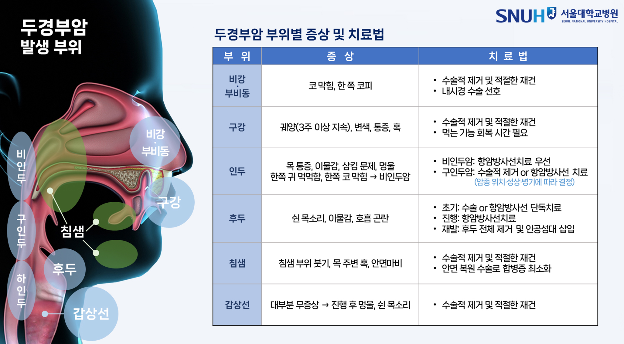 두경부암 발생 부위별 증상 및 치료법