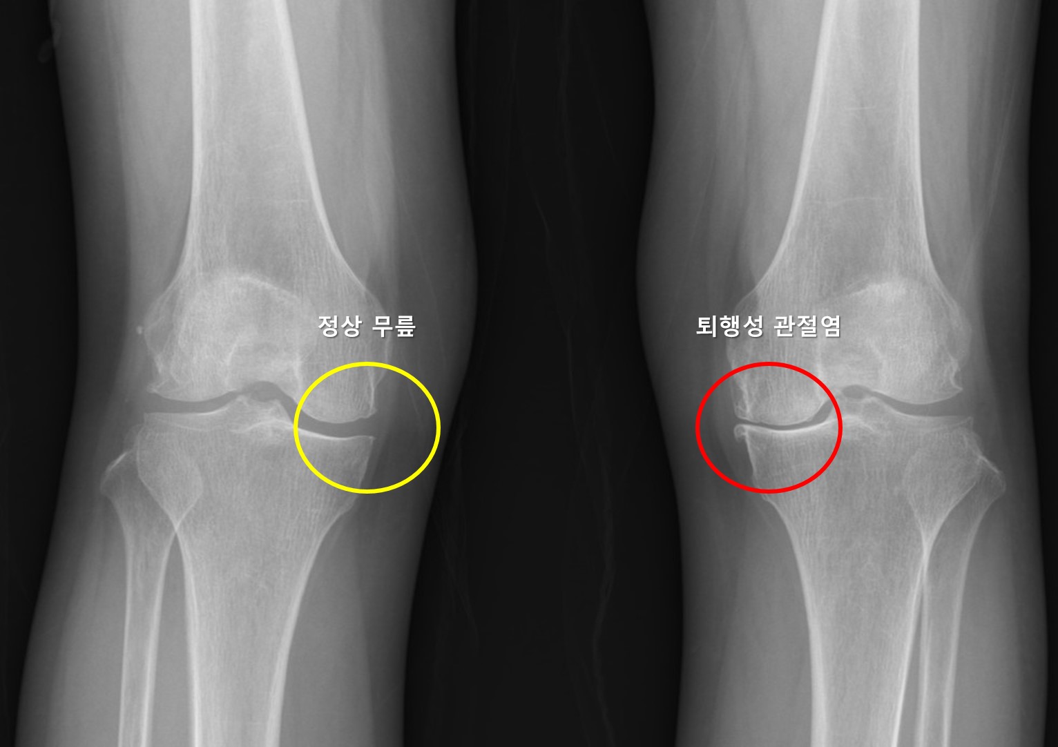 X-ray 이미지 X-ray 이미지