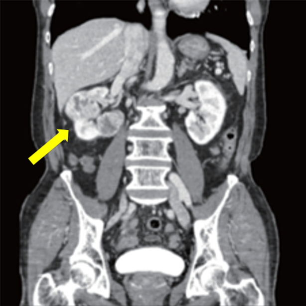 external_image