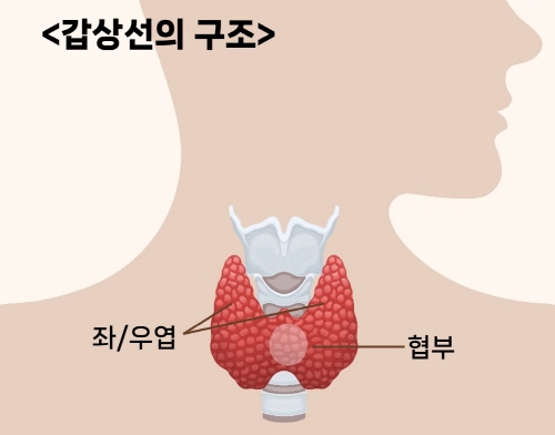 [병원뉴스]저위험 갑상선 협부암 환자, 협부절제술도 안전하고 효과적