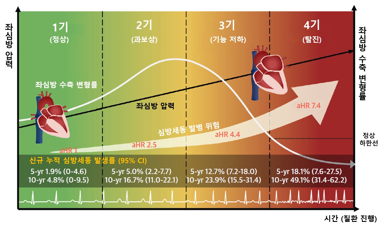 [병원뉴스]비후성 심근증 심방세동 위험 가려내는 '좌심방 4단계 병기 체계' 개발