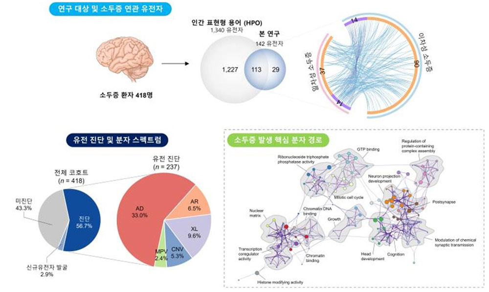 [병원뉴스]서울대병원·KAIST, 국내 소두증 유전자 스펙트럼 규명