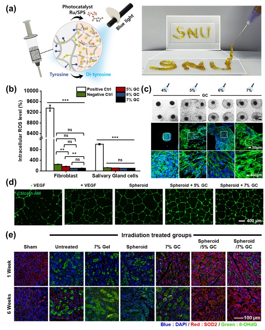 [병원뉴스]서울대병원, 난치성 '구강건조증' 근본적으로 치료하는 융합 시스템 개발