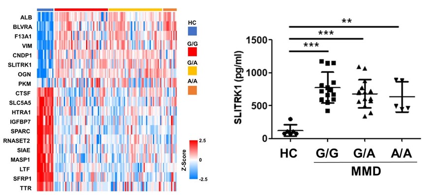 [그림1] 모야모야병 환자군 및 대조군의 뇌척수액 단백체 분석 결과