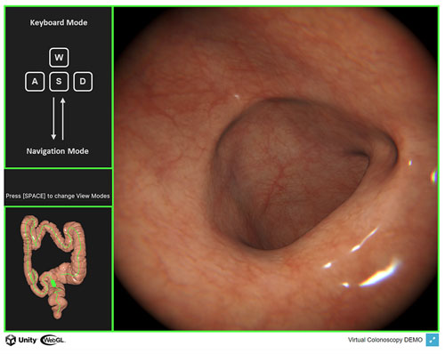 [자료1] AI 기반 내시경 시뮬레이터(SeamXSim-T) 구동 화면