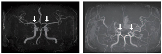 external_image external_image