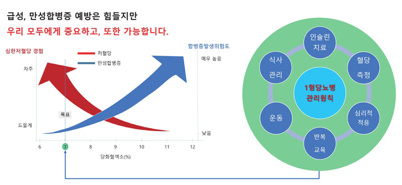 [이미지3] 저혈당과 합병증 위험을 동시에 낮추기 위한 1형당뇨병 관리 목표와 핵심 원칙