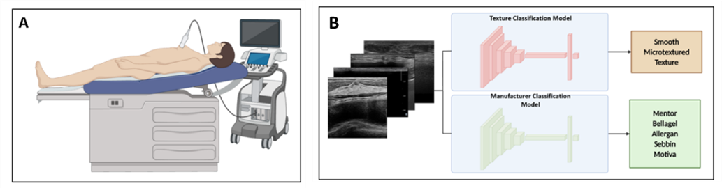 본 연구에서 개발한 인공지능(AI)을 활용한 유방 보형물 자동 식별 및 분류 과정