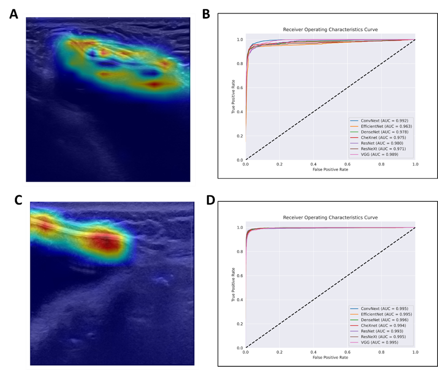 인공지능(AI)의 보형물 판독 근거 시각화 및 분류 성능 분석 결과