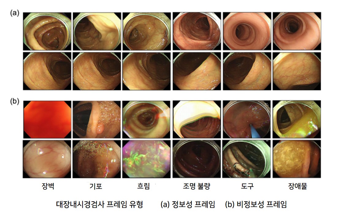 [이미지2] InfoColon 프레임 유형