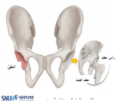 external_image