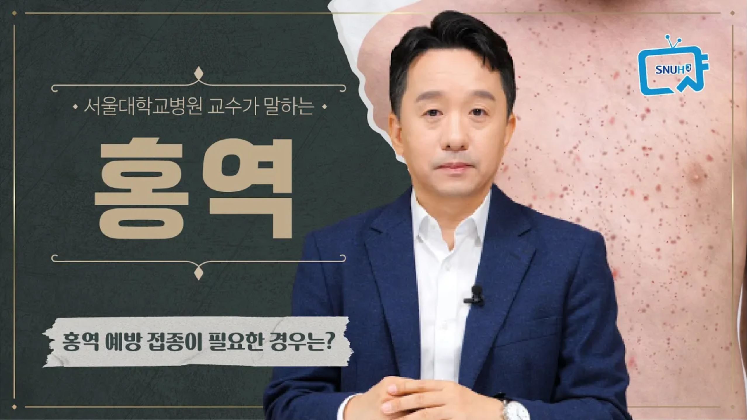 [FOCUS]홍역의 증상, 진단, 치료와 추가 <!HS>예방접종<!HE>이 필요한 경우