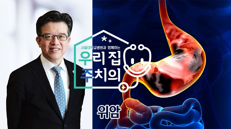[우리집 주치의]<!HS>위암<!HE> 원인과 예방 및 치료 방법