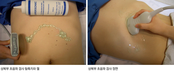 초음파 검사 장면
