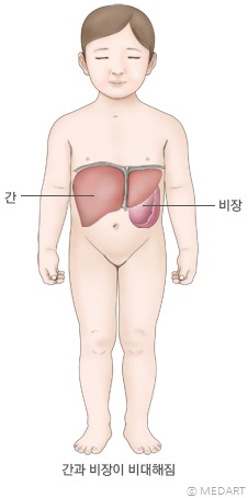 소아 백혈병 증상